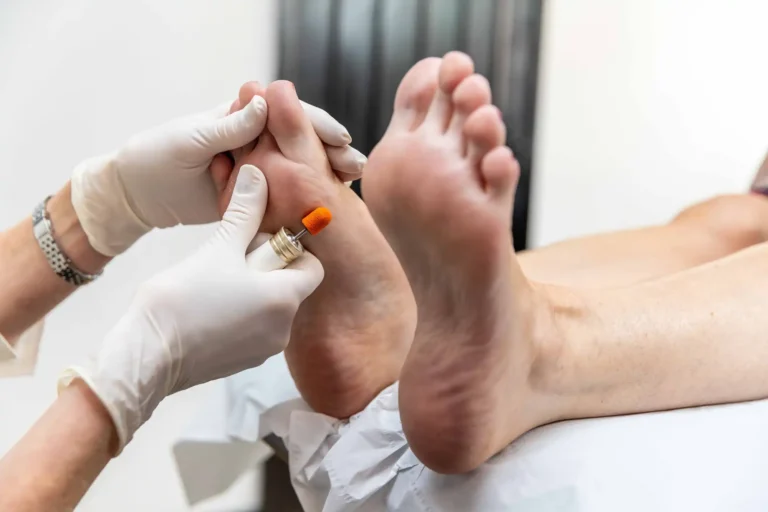 Podiatrist Warwickshire