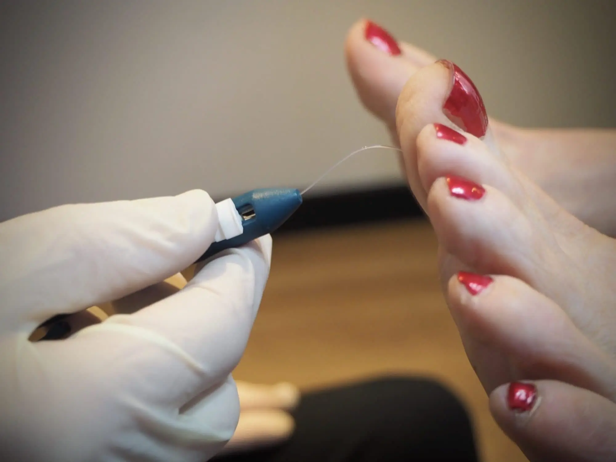P7030265 scaled FIXED Podiatry & Chiropody in Warwickshire
